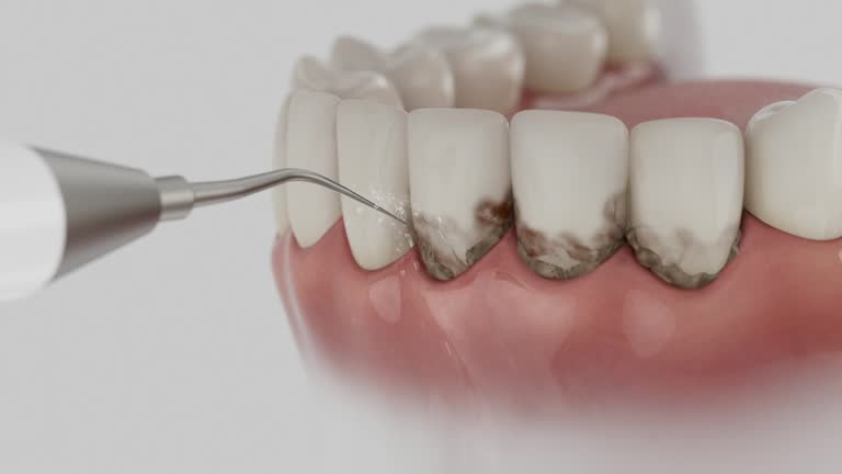 Trusted Tooth Extraction service in Lyons, OR - Dentist Open Now